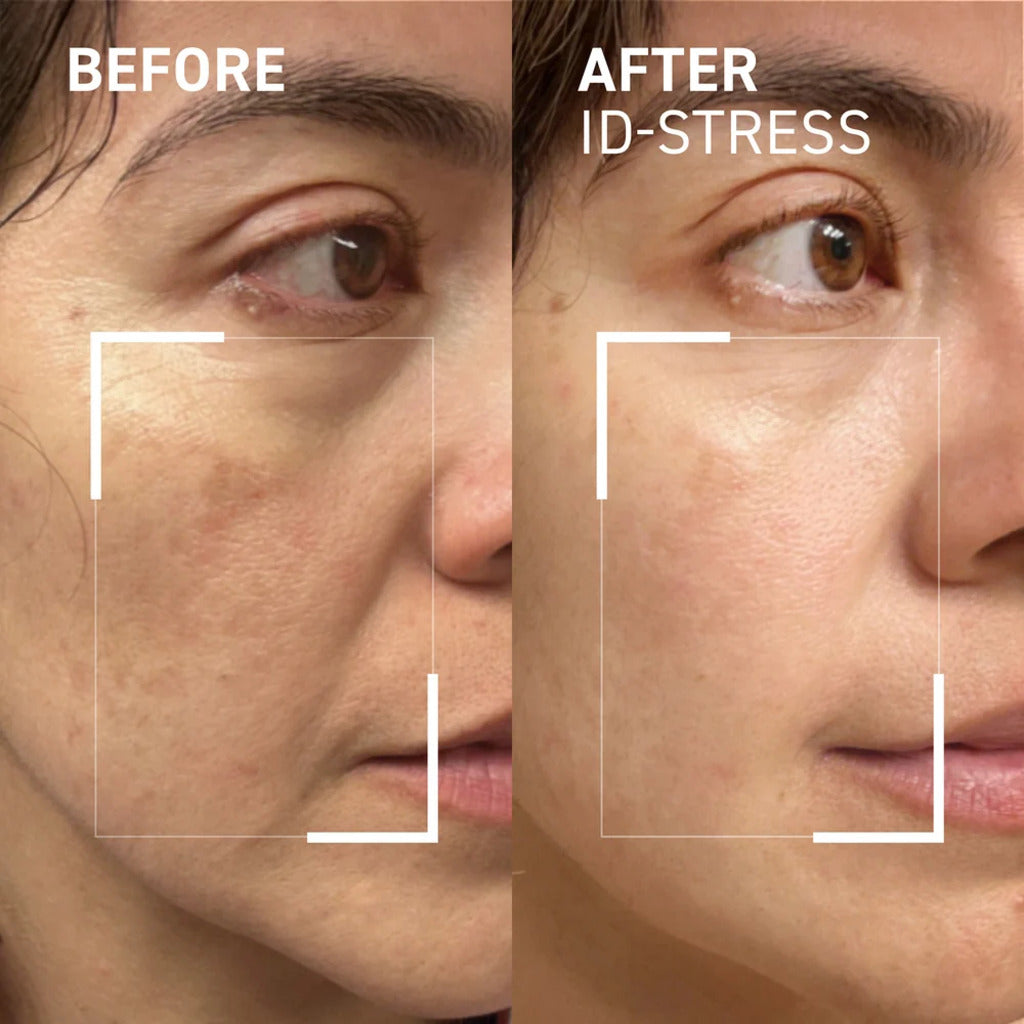 Brand before-and-after facial close-ups used to illustrate iD-STRESS results
