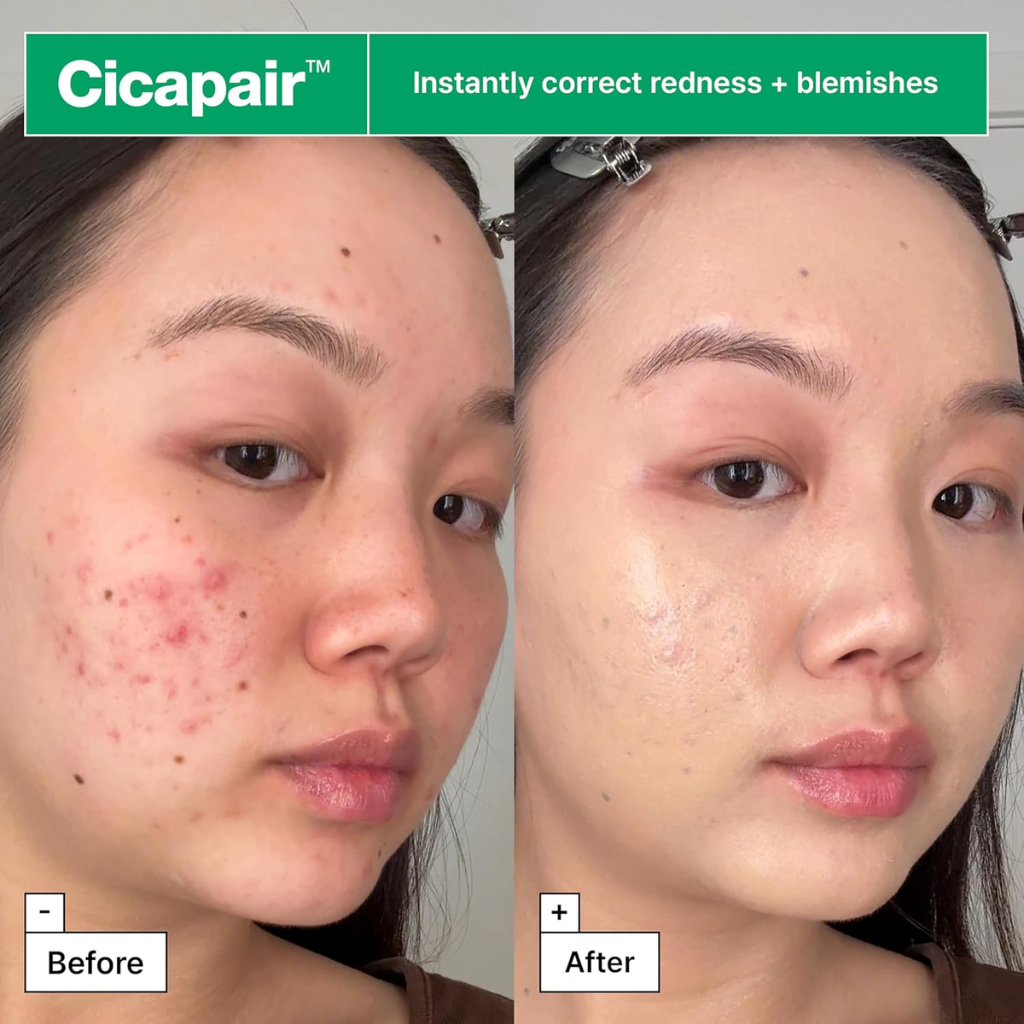 Before-and-after facial views illustrating corrected redness and blemishes with Dr. Jart+ Cicapair treatment.