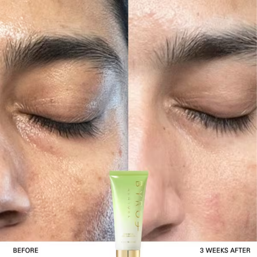 BYROE Kiwi Detox Gel Cleanser key ingredients and benefits