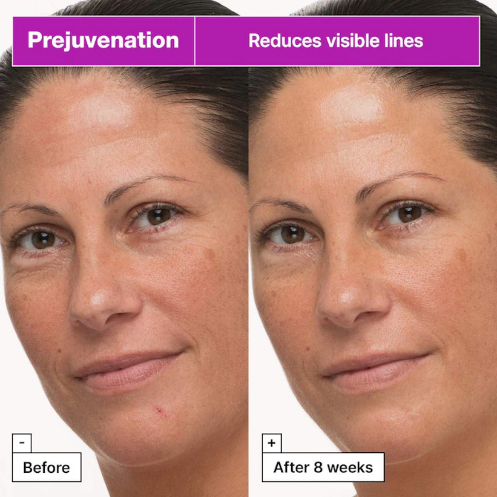 Before-and-after-eight-weeks facial views illustrating the look of lines with Dr. Jart+ Prejuvenation Cream.
