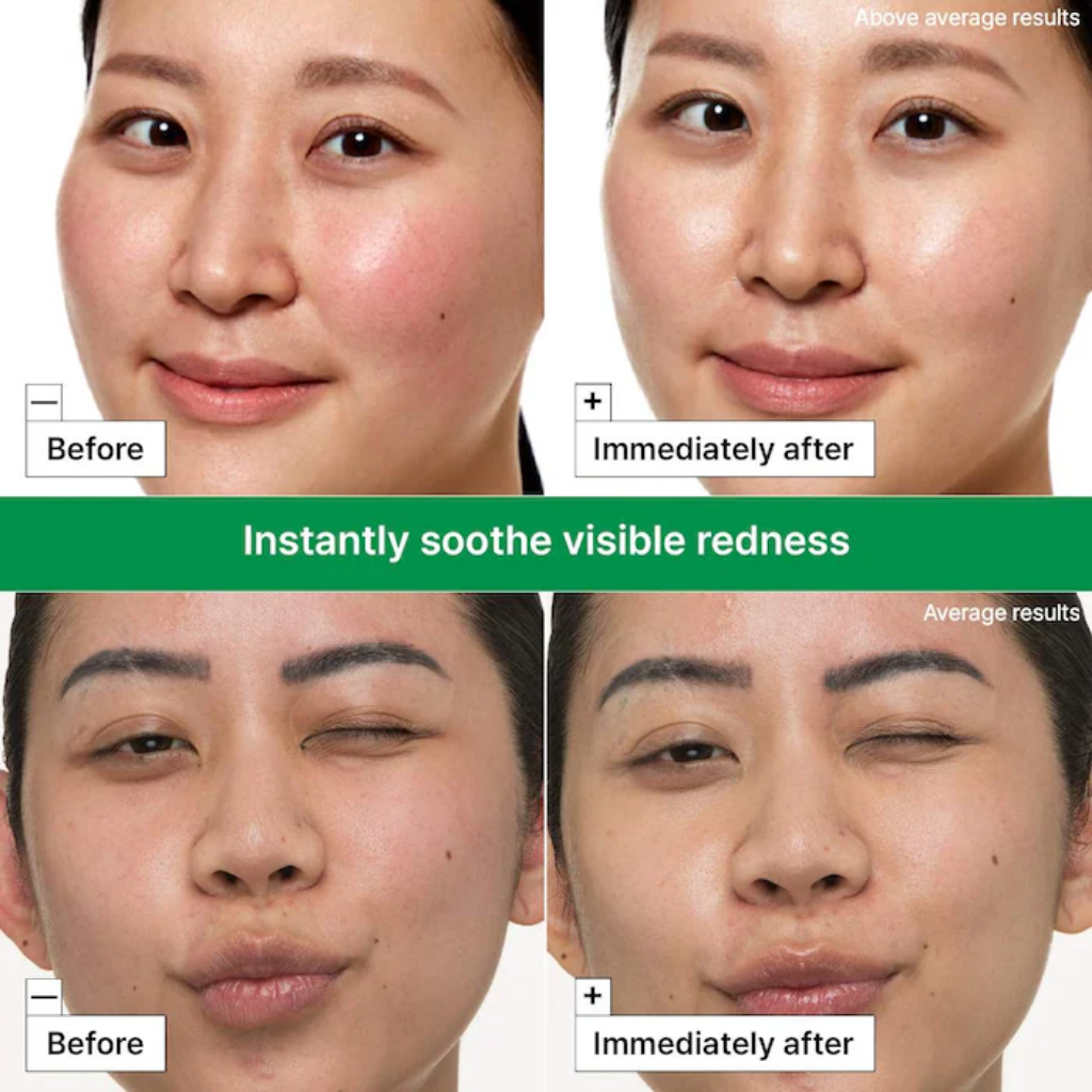 Before-and-immediately-after facial views illustrating visible redness with Dr. Jart+ Cicapair Repair Cream.