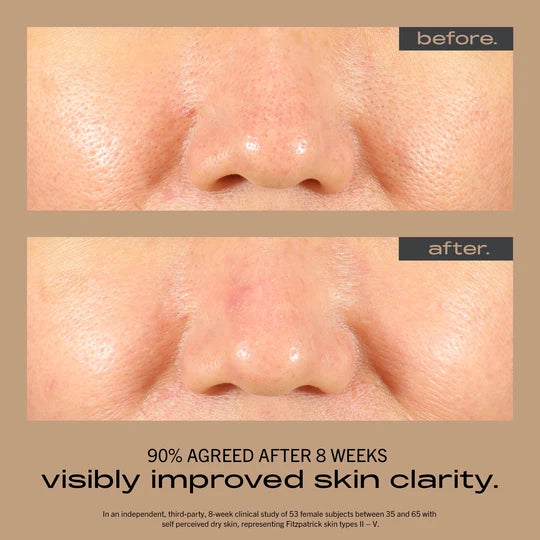 Manufacturer before-and-after nose-area photos illustrating improved skin clarity after eight weeks