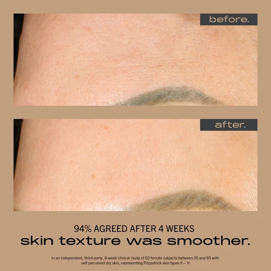 Manufacturer before-and-after forehead photos illustrating smoother texture after four weeks