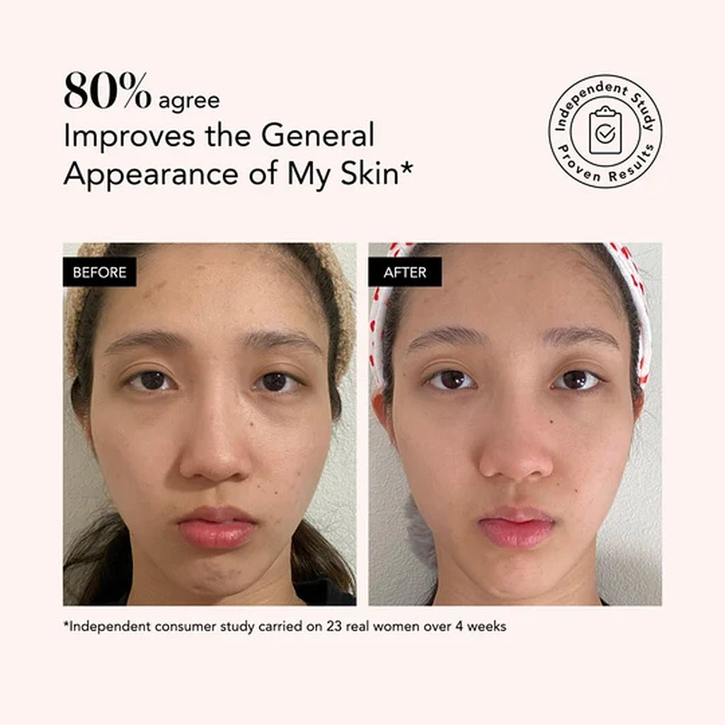 Odacité Clarifying Serum independent study result: 80 percent agree skin’s general appearance improved