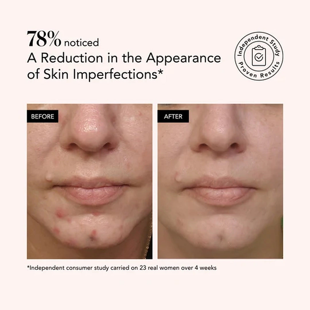 Odacité Clarifying Serum independent study result: 78 percent noticed reduced appearance of skin imperfections